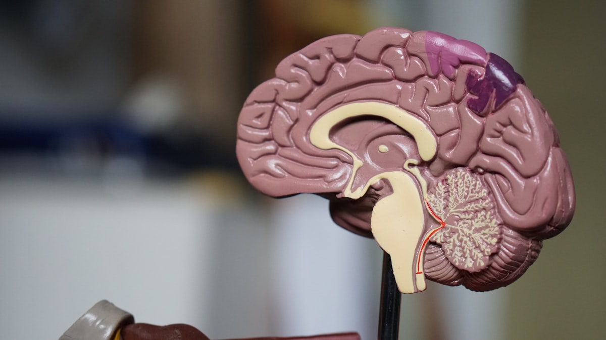 Brain model representing Alzheimer's disease and the growing research into medicinal cannabis for dementia symptom management and potential neuroprotection in Australia