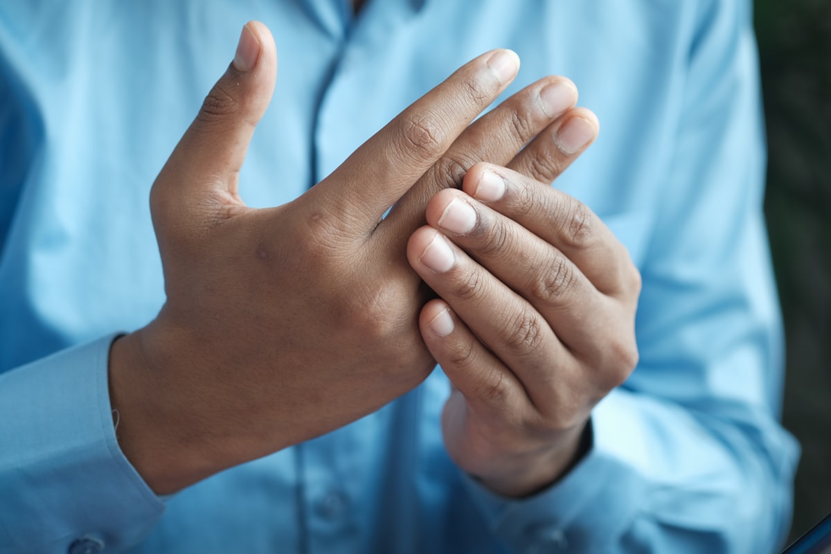 Close-up of a hand with joint inflammation representing the 3.6 million Australians living with arthritis who are exploring medicinal cannabis for pain relief
